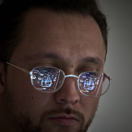 Clinician utilizes ultrasound AI which can be seen in a reflection in his glasses