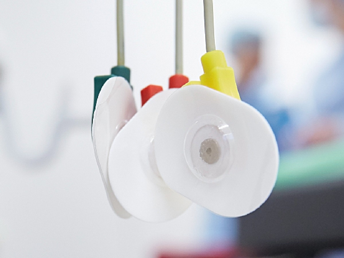 While electrode misplacement can and does affect most patients—occurring in more than 50 percent of cases, according to an estimate in the Circulation paper—certain errors linked to sex can drive inequities in cardiovascular medicine and worsen existing disparities.