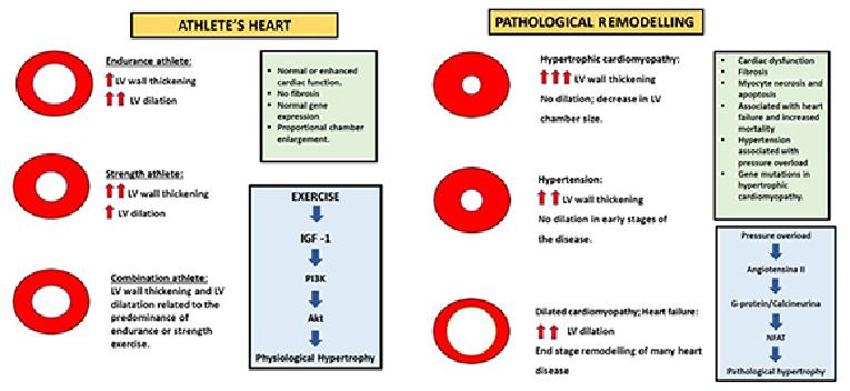 v14_36__Figure 1-Cardiac dysfunction and athlete&rsquo;s heart.jpg