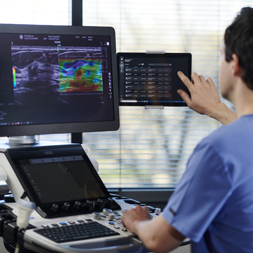 A sonographer used Verisound Collab, available as an ultrasound software subscription, while sitting at an ultrasound machine.