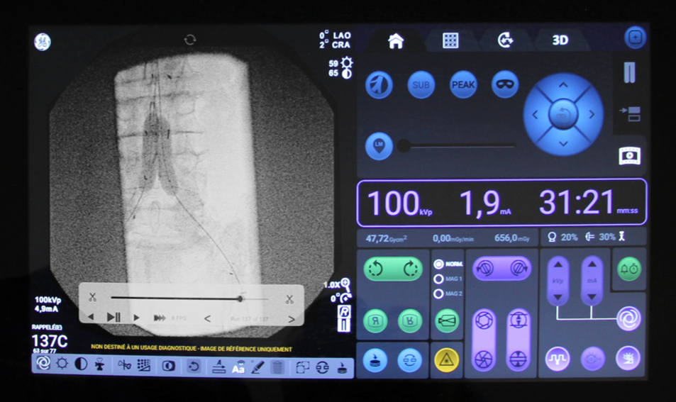 OEC 3D user interface.jpg