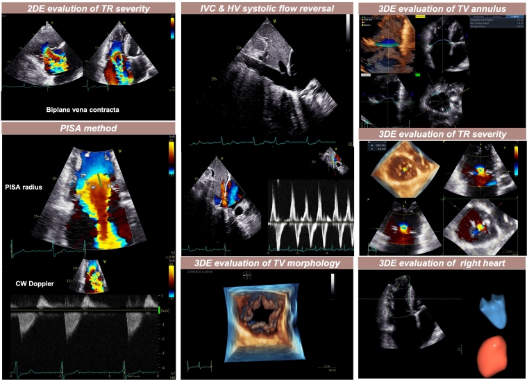 330_Muraru_CENTRAL FIGURE_escardio-hPhotoLarge.jpg