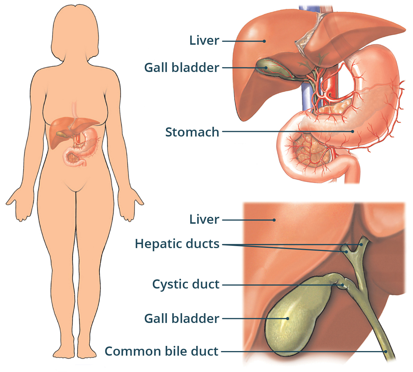 Illustration showing anatomy of the liver and gallbladder before cholecystectomy