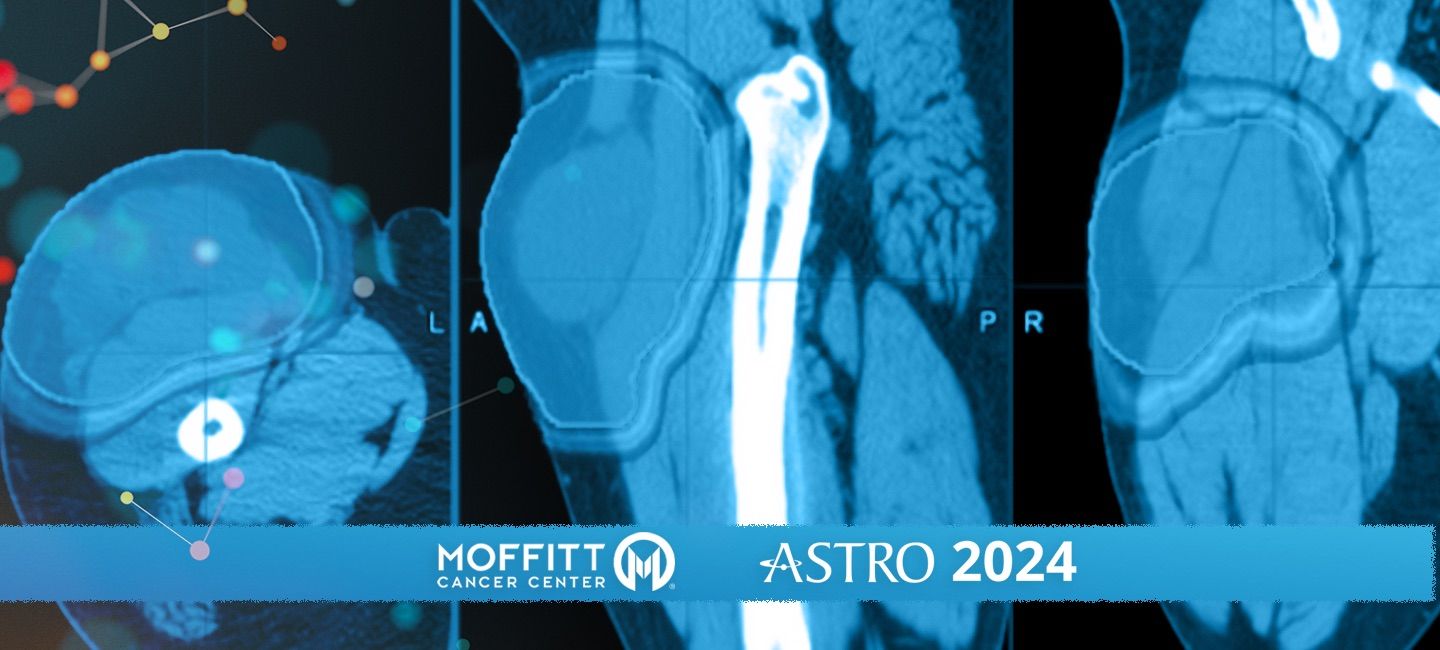 ASTRO 2024 STS