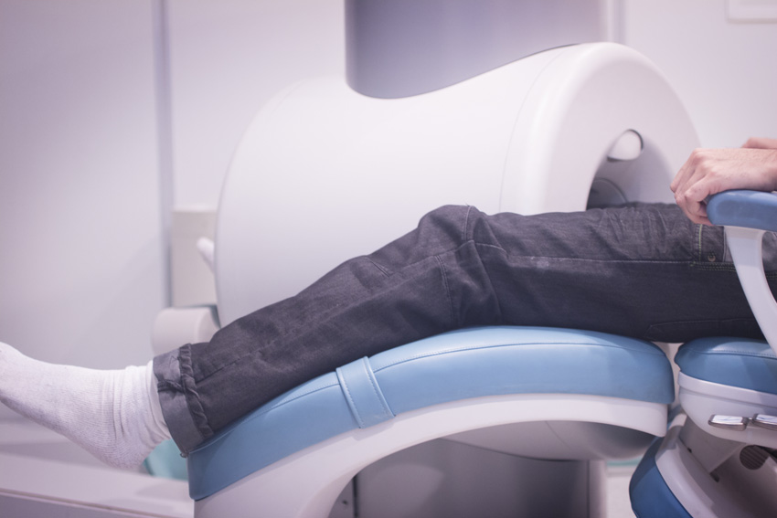 Pacient s poškodovanim kolenom na MRI. Simbolna fotografija za hitro okrevanje po smučarski poškodbi.