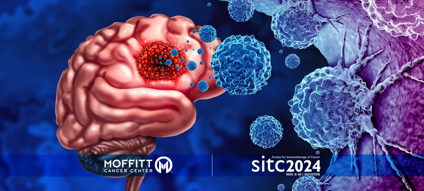 graphic image of a brain with a tumor and cancer cells