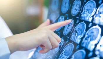 Stereotactic Radiosurgery