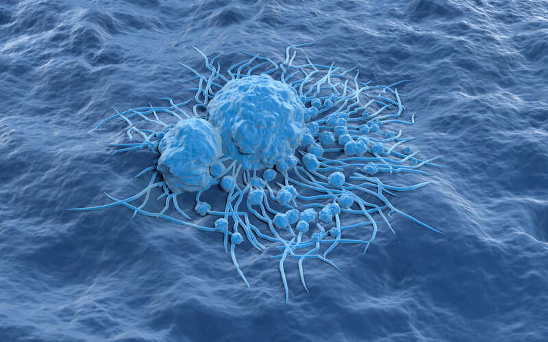 graphic image of cancer cells