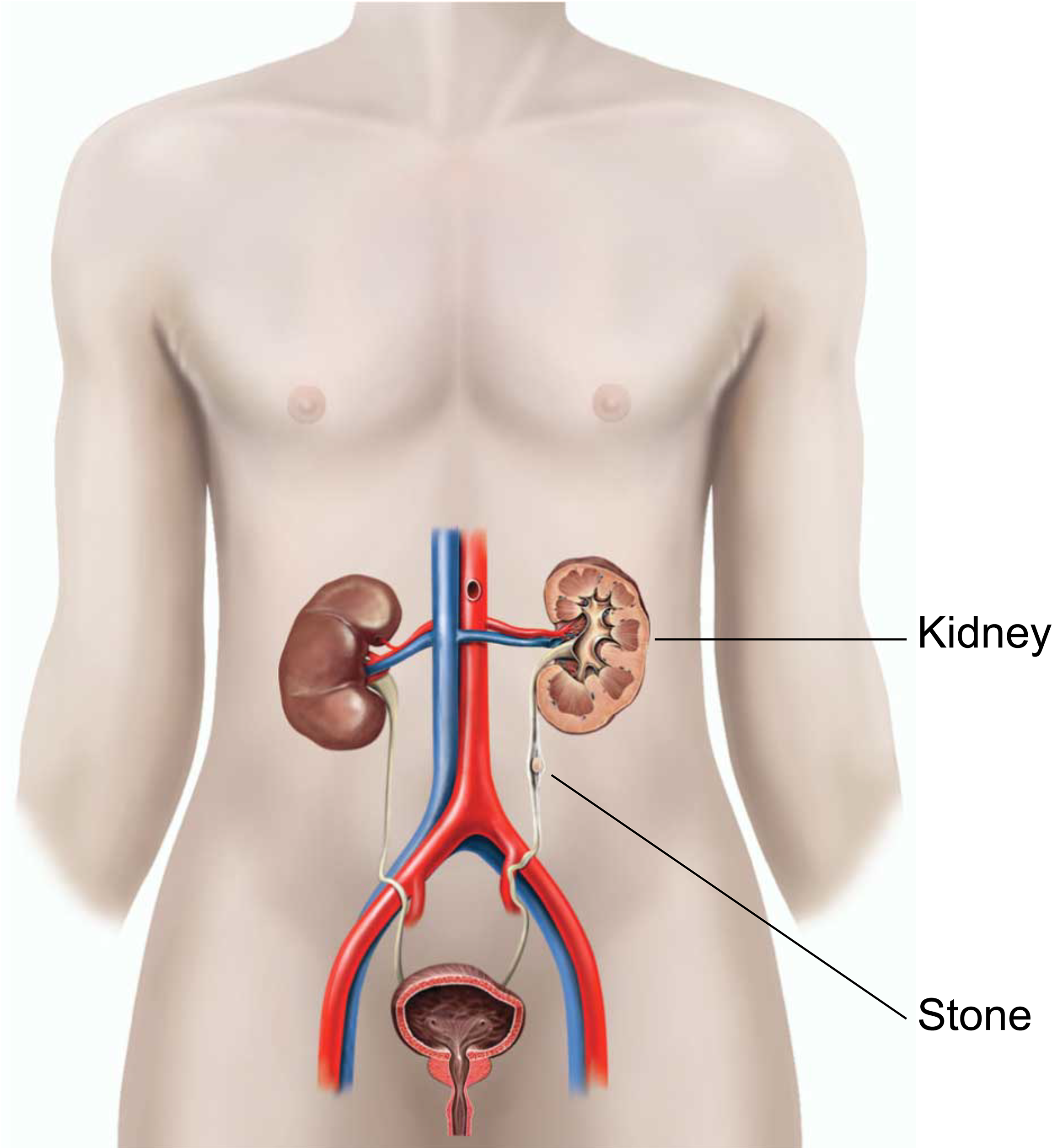 An illustration showing the position of the prostate gland.