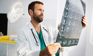 Mlad zdravnik si ogleduje posnetek možganov. Simbolna fotografija za preučevanje alzheimerjeve bolezni.