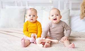 Dojenčla dvojčka - levi ima na čelu infantilni hemangiom